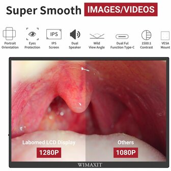 Display (1920x1280P) with mounting system for Prima/Magna