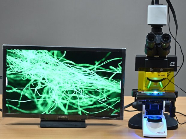 Triple Filter LED Fluorescence attachment with UV for Lx400 and Lx500